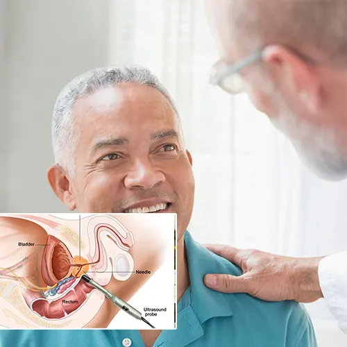 Choosing  Greater Long Beach Surgery Center

for Your Penile Implant Surgery